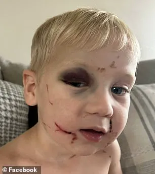 Georgia Daycare Worker Arrested on Child Abuse Charges After Alleged Attack on 1-Year-Old on First Day of School