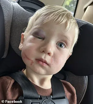 Georgia Daycare Worker Arrested on Child Abuse Charges After Alleged Attack on 1-Year-Old on First Day of School