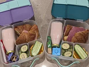 Mother Sparks Controversy Over Laser Treatment to Remove Toddler's Facial Birthmark Amid Bullying Fears