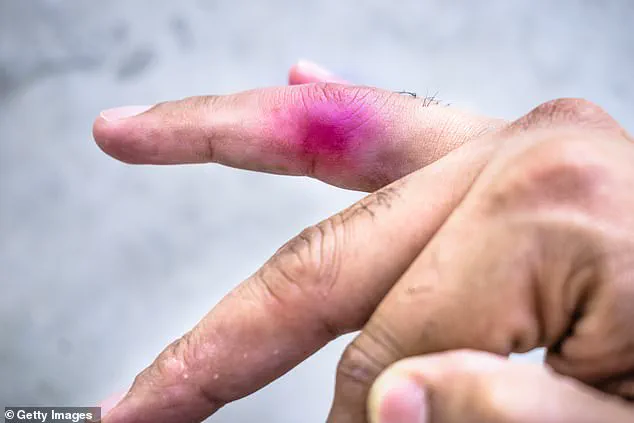 Rare Legal Battle Between Minors Over Toy Dinosaur Injury at Undisclosed Alberta Daycare