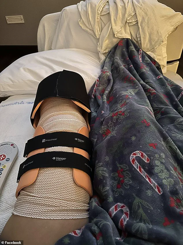 Tragic Pit Bull Attack and Amputation Prompt Debate on Pet Ownership and Safety