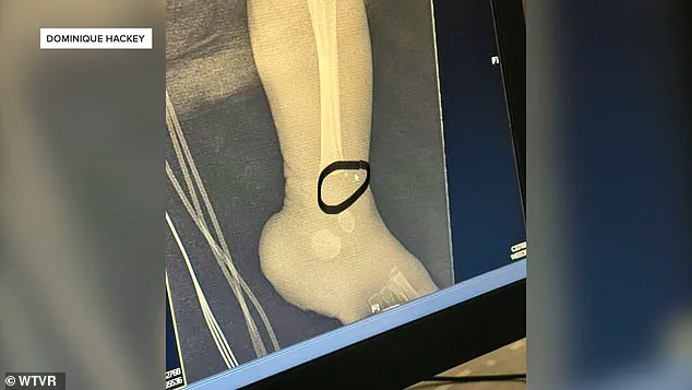 Neonatal Nurse Pleads No Contest to Child Abuse Charges, Facing Prison and Lifetime Healthcare Ban as Patient Safety Alarms Rise