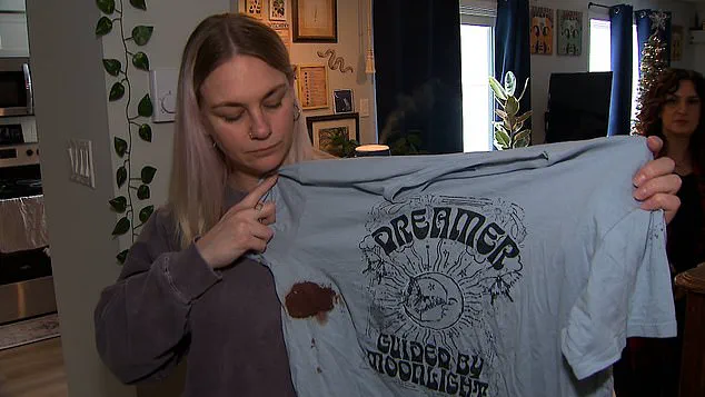 Urgent: Dog Attack in Oshawa Leaves Two Mothers and Child Injured on January 13