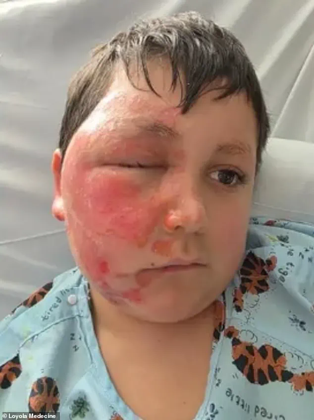 Nine-Year-Old Suffers Severe Burns Microwaving Needoh Cube in TikTok Trend