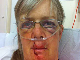 Firefighters Rescue Dog Walker Trapped by Charging Cow on Isle of Wight