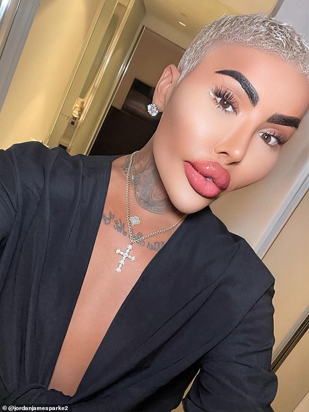 Flamboyant TV Personality 'The Lip King' Dies; Police Probe Cosmetic Procedure Link