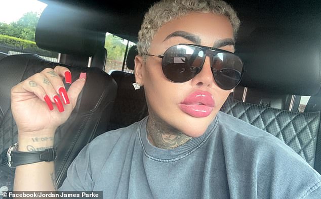 Flamboyant TV Personality 'The Lip King' Dies; Police Probe Cosmetic Procedure Link