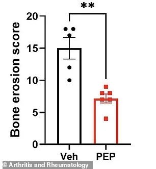 New Therapy Hope for Inflammatory Arthritis