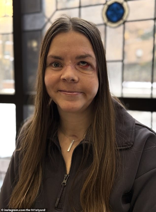 Kenai Mother Reveals Terrifying Details of Grizzly Bear Attack