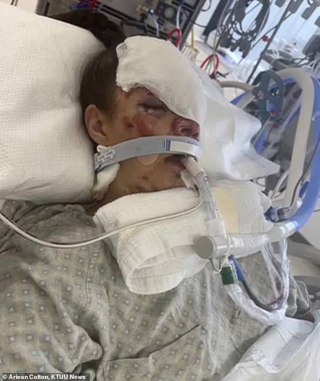 Kenai Mother Reveals Terrifying Details of Grizzly Bear Attack