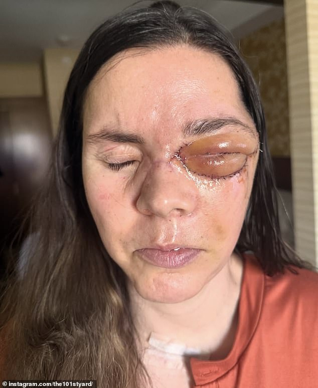 Kenai Mother Reveals Terrifying Details of Grizzly Bear Attack