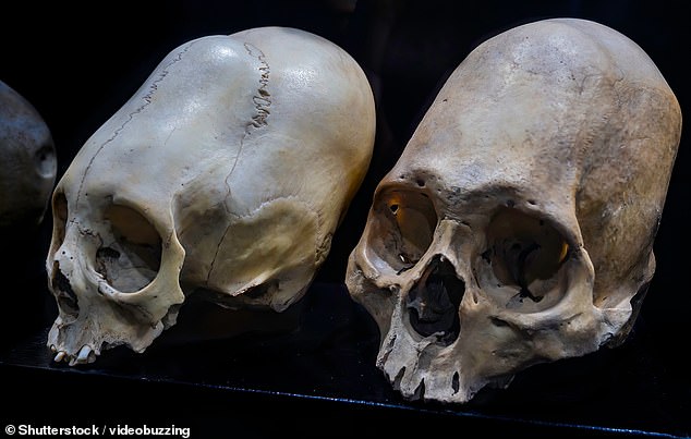 DNA study fails to confirm alien origins of ancient Peruvian conehead mummies.