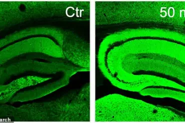 Scripps Researchers Unveil Potential New Treatment for Alzheimer's Using Natural Compounds from Rosemary and Sage