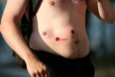 LAPD Deploys Rubber Bullets in Escalated Protest Response, as Clashes Intensify Near City Center Building