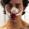 New York City Model Suffers Severe Injuries After Heroic Intervention in Dresden Attack