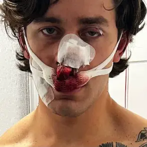 New York City Model Suffers Severe Injuries After Heroic Intervention in Dresden Attack