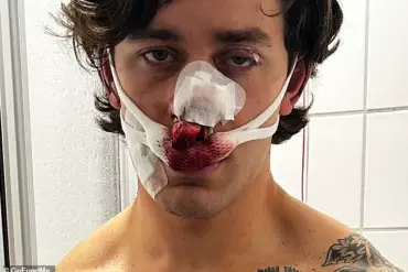 New York City Model Suffers Severe Injuries After Heroic Intervention in Dresden Attack
