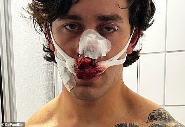 New York City Model Suffers Severe Injuries After Heroic Intervention in Dresden Attack