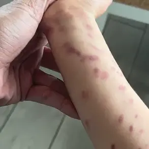 Octopus Incident at San Antonio Aquarium Leaves 6-Year-Old Boy with Bruises