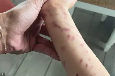 Octopus Incident at San Antonio Aquarium Leaves 6-Year-Old Boy with Bruises