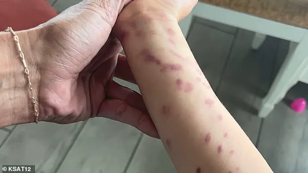 Octopus Incident at San Antonio Aquarium Leaves 6-Year-Old Boy with Bruises
