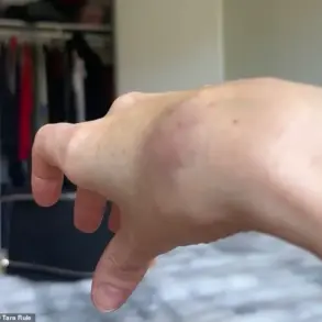 TikTok Influencer Claims American Airlines Refused Help Stowing Carry-On, Highlighting Disability Accommodation Issues in Air Travel