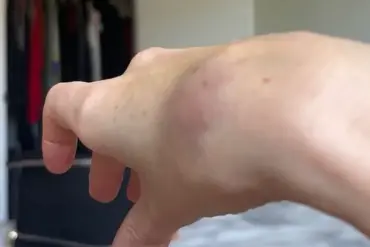 TikTok Influencer Claims American Airlines Refused Help Stowing Carry-On, Highlighting Disability Accommodation Issues in Air Travel